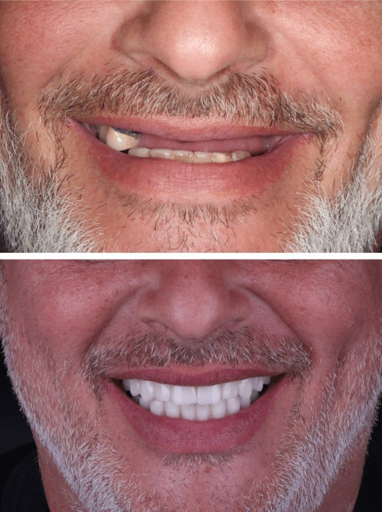 photo of the patient's smile