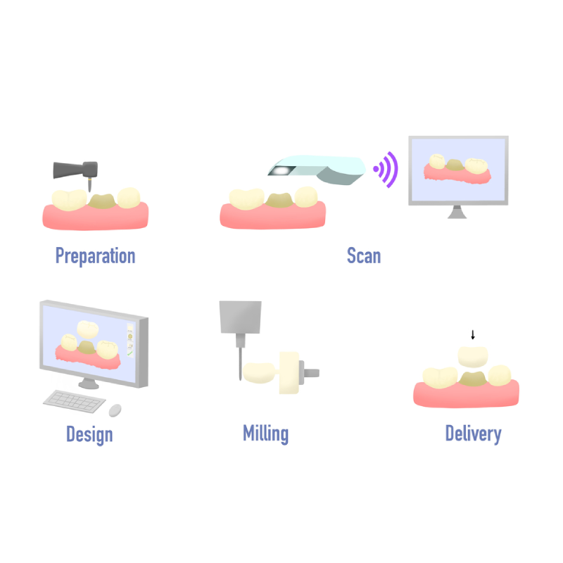 stages of dental prosthetics