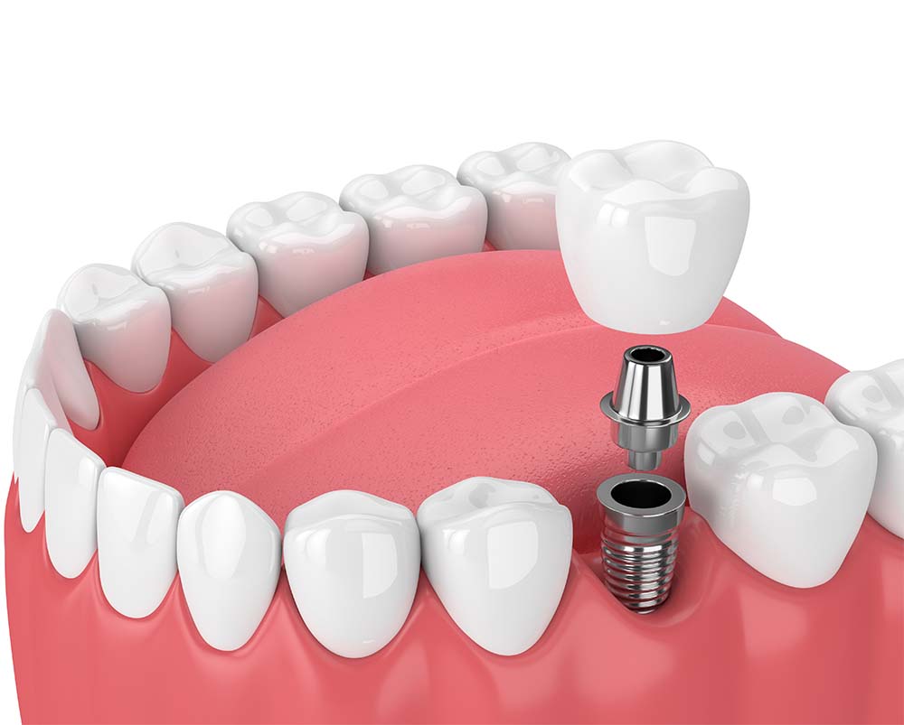 What is the role of a Periodontist?